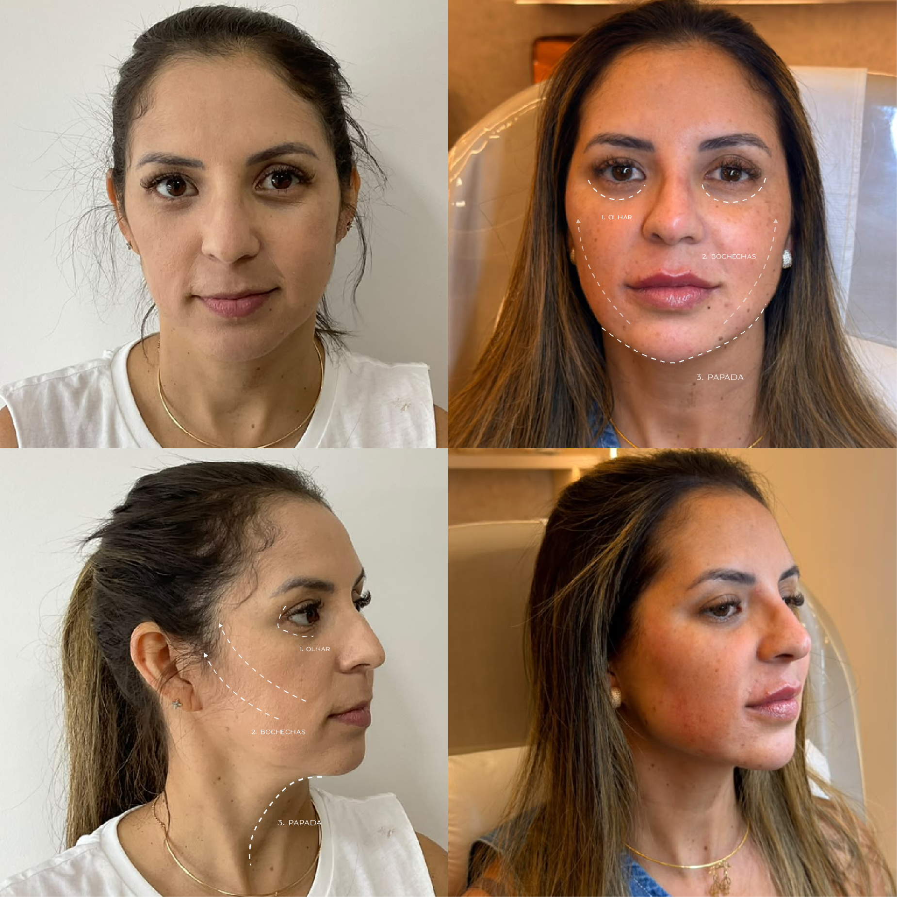 FOTOS-FACE-CONCEPT-10.png